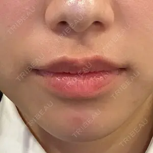 TCB東京中央美容外科 梅田茶屋町院口コミ