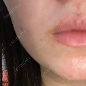 L‘amour clinic Tokyo【ラムールクリニック東京】口コミ