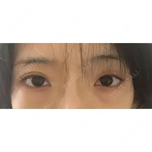東京シンデレラ美容外科 東京シンデレラ美容外科 池袋院口コミ