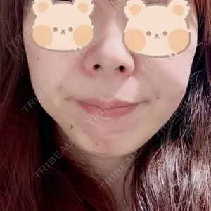 AYANAフィラーズクリニック AYANAフィラーズクリニック 渋谷院口コミ