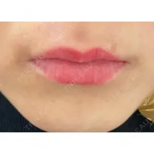 ルラ美容クリニック ルラ美容クリニック 名古屋栄院口コミ