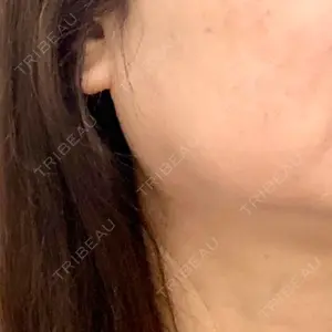 TCB東京中央美容外科 TCB東京中央美容外科 立川院口コミ