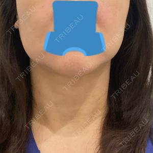TCB東京中央美容外科 TCB東京中央美容外科 立川院口コミ