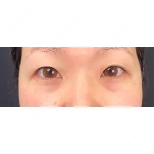 東京シンデレラ美容外科 東京シンデレラ美容外科 池袋院口コミ