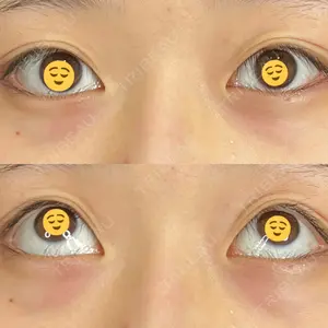 藤・ナチュレ美容クリニック 藤・ナチュレ美容クリニック 銀座院口コミ