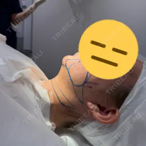 EMMO FACE CLINIC EMMO FACE CLINIC 大阪梅田院口コミ