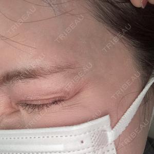 湘南美容クリニック 湘南美容クリニック 大阪梅田本院口コミ
