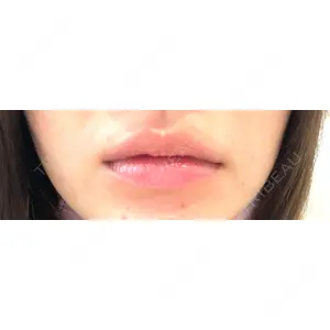 R Beauty CLINIC R Beauty CLINIC 銀座院口コミ