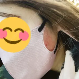 TCB東京中央美容外科 福岡博多院口コミ