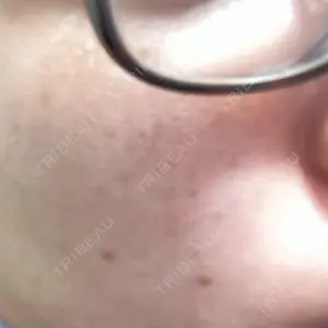 おおかみ美容のクリニックの口コミ