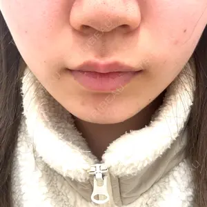 ルラ美容クリニック ルラ美容クリニック 新宿院口コミ