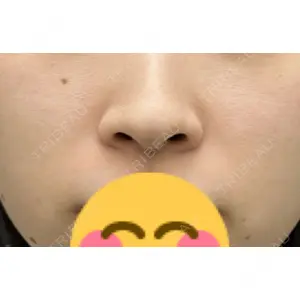 渋谷の森クリニック口コミ