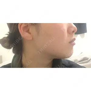 口コミ