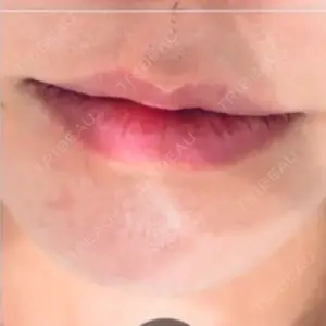 R Beauty CLINIC R Beauty CLINIC 銀座院口コミ