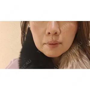 EMMO FACE CLINIC EMMO FACE CLINIC 東京三田院口コミ