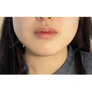 共立美容外科・歯科 共立美容外科 梅田院口コミ