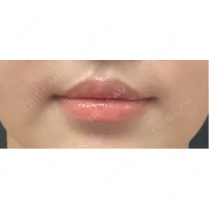 R Beauty CLINIC R Beauty CLINIC 銀座院口コミ