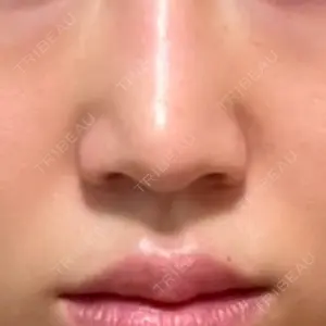 口コミ