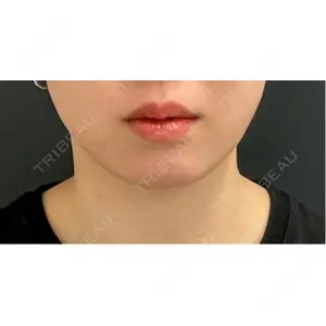 ルラ美容クリニック ルラ美容クリニック 池袋院口コミ