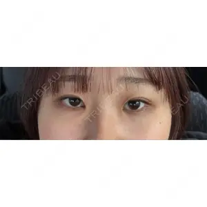 口コミ