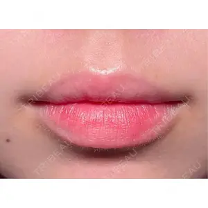 R Beauty CLINIC R Beauty CLINIC 銀座院口コミ