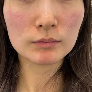 DMTC美容皮膚科 DMTC美容皮膚科 日本橋院口コミ