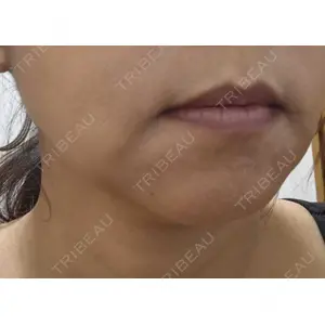 NARU Beauty Clinic NARU Beauty Clinic 【ナルクリ】口コミ
