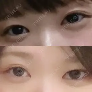口コミ