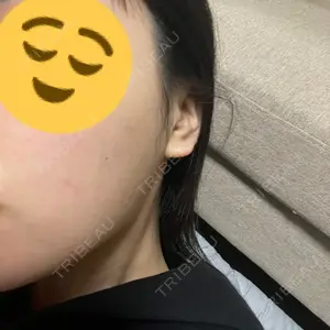 TCB東京中央美容外科 TCB東京中央美容外科 宇都宮院口コミ