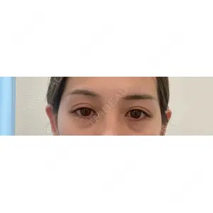 東京シンデレラ美容外科 東京シンデレラ美容外科 池袋院口コミ