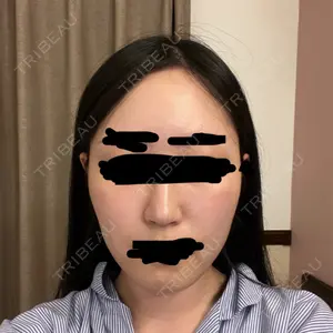 セギム美容整形外科口コミ