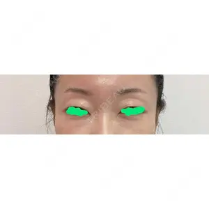 口コミ