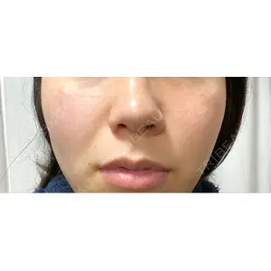 聖心美容クリニック グループ S-Laboクリニック 渋谷院口コミ