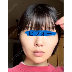 湘南美容クリニック 調布院口コミ
