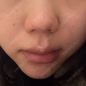 おおかみ美容のクリニック おおかみ美容のクリニック 横浜院口コミ