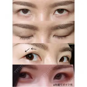 BIANCA CLINIC BIANCA銀座口コミ