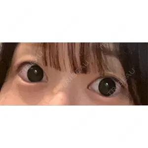 口コミ