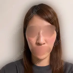 セギム美容整形外科口コミ