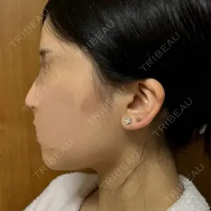 セギム美容整形外科口コミ