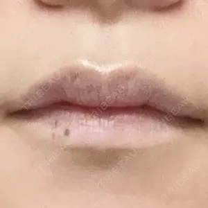 口コミ
