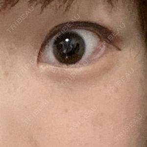 銀座リシェスクリニック口コミ