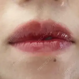 BiBiクリニック口コミ