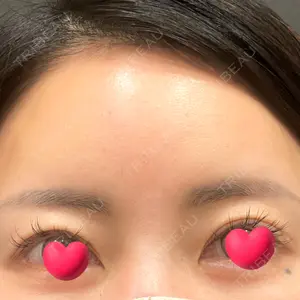 YBC横浜美容外科 YBC横浜美容外科 池袋院口コミ