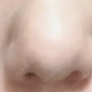 Zetith Beauty Clinic 福岡院口コミ