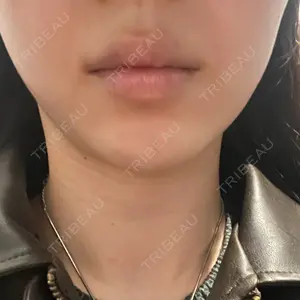 口コミ