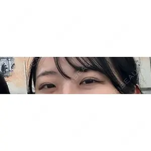 LUHO（ルホ）美容外科口コミ