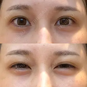 HAAB×DREAM BEAUTY CLINIC HAAB×DREAM BEAUTY CLINIC 東京本院口コミ