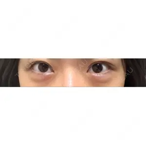 HAAB×DREAM BEAUTY CLINIC HAAB×DREAM BEAUTY CLINIC 大阪梅田院口コミ