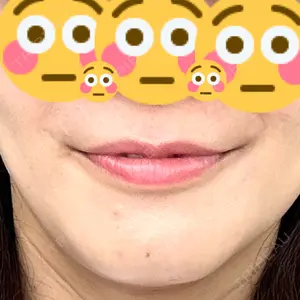 L‘amour clinic Tokyo【ラムールクリニック東京】口コミ