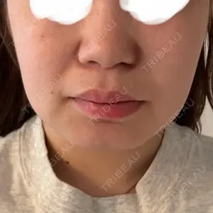 口コミ